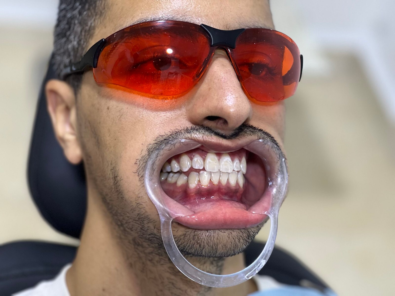 Après traitement, patient 1